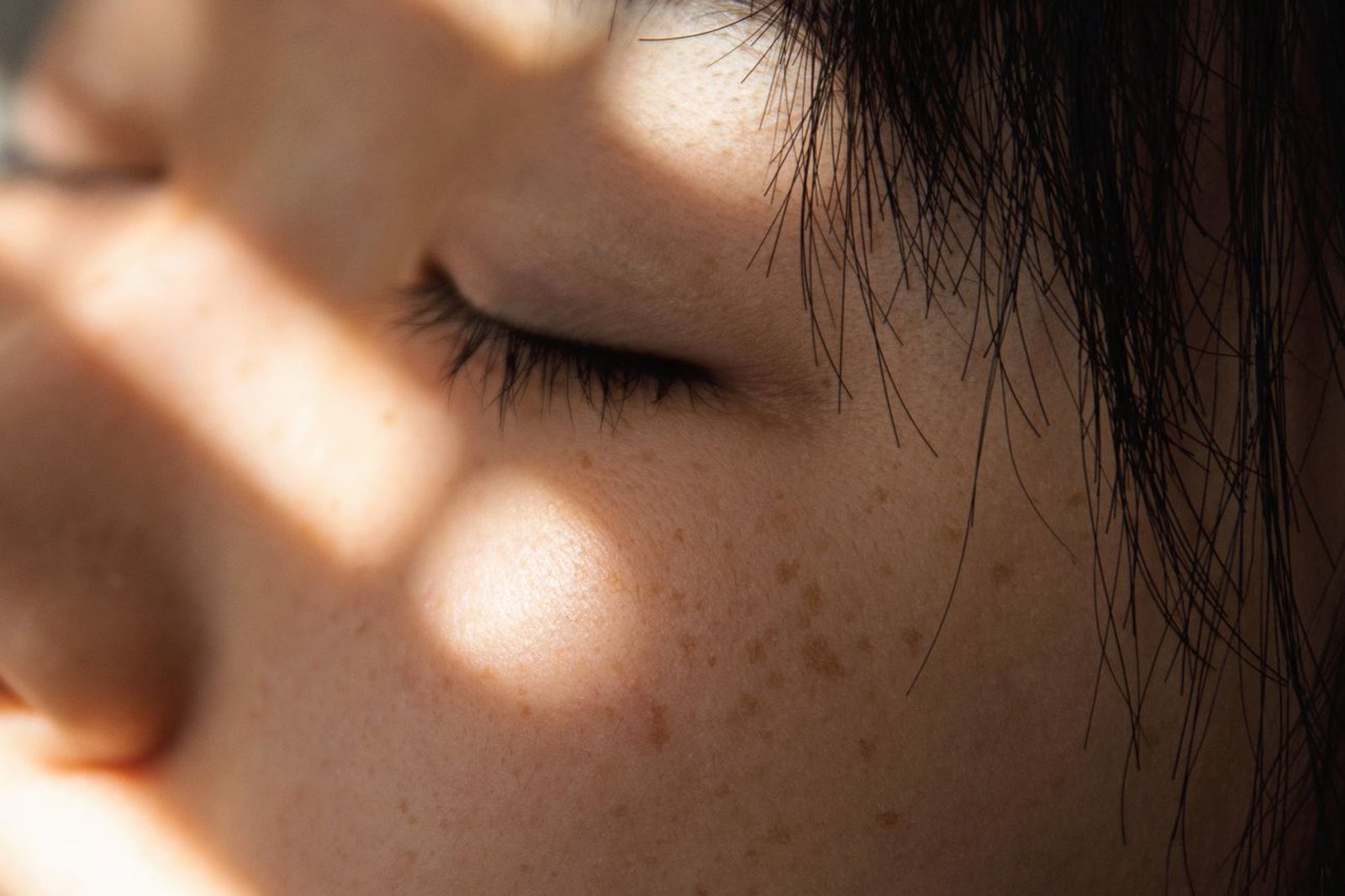 Skin Boosters